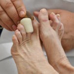 Dental Root Planing Explained by a General Dentist
