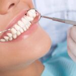 What to Know About Invisalign From a General Dentist