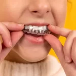 How to Deal with Dental Anxiety Easily