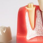 Zolpidem Tartrate: A Complete Guide to Sleep Aid Benefits