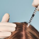 Empowering Your Journey: Combatting Hair Loss with Innovative Solutions